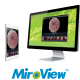 MiroView 4 Software